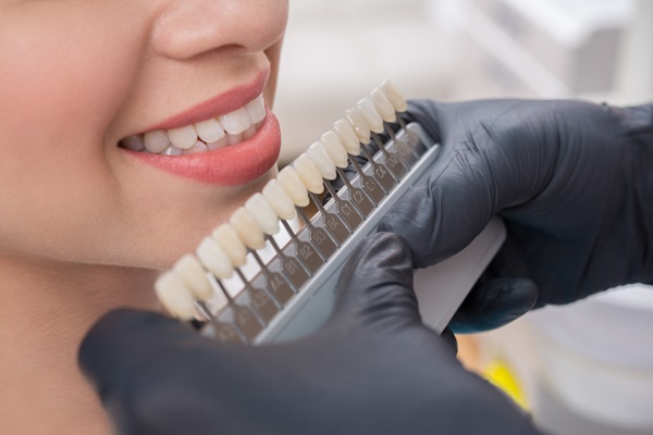 How To Care For Dental Veneers