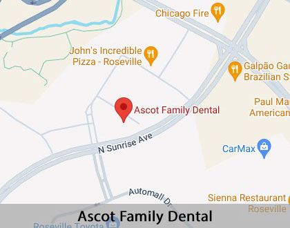 Map image for Interactive Periodontal Probing in Roseville, CA